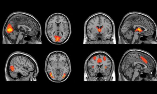 Large Machine-Learning Study Searches for Diagnostic Biomarkers in Major Depressive Disorder