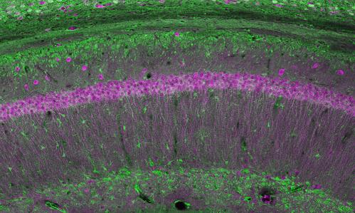 Variations in Schizophrenia-Linked Gene Are Linked With Pathology in Prefrontal Cortex, Impairing Cognition
