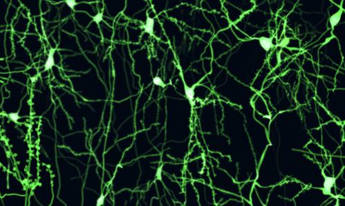 Alterations in Inhibitory Control After Eating Are Seen in Women with History of Bulimia Nervosa