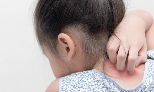 Insights Into Sensory Symptoms in Autism and Other Disorders from Stem Cell-Based Model of Key Human Sensory Pathway